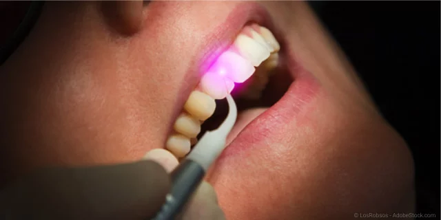 Laser-Behandlung